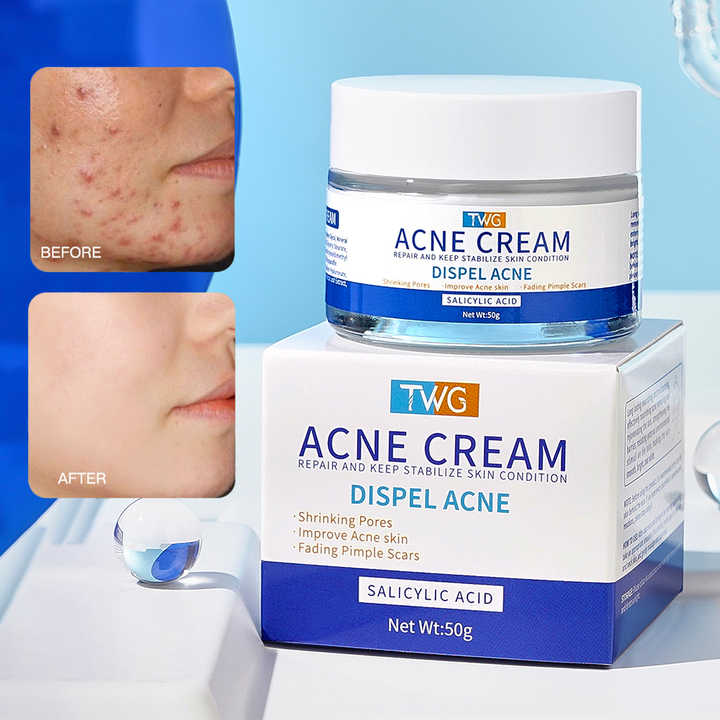 ClearGlow™ Acne Relief Cream