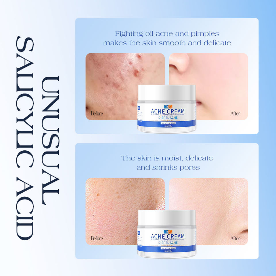 ClearGlow™ Acne Relief Cream