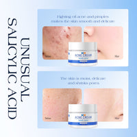 ClearGlow™ Acne Relief Cream