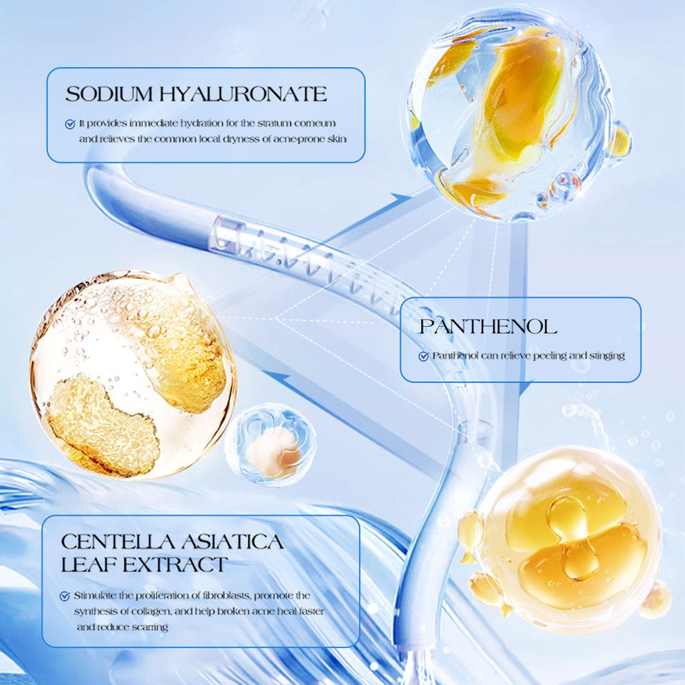 ClearGlow™ Acne Relief Cream